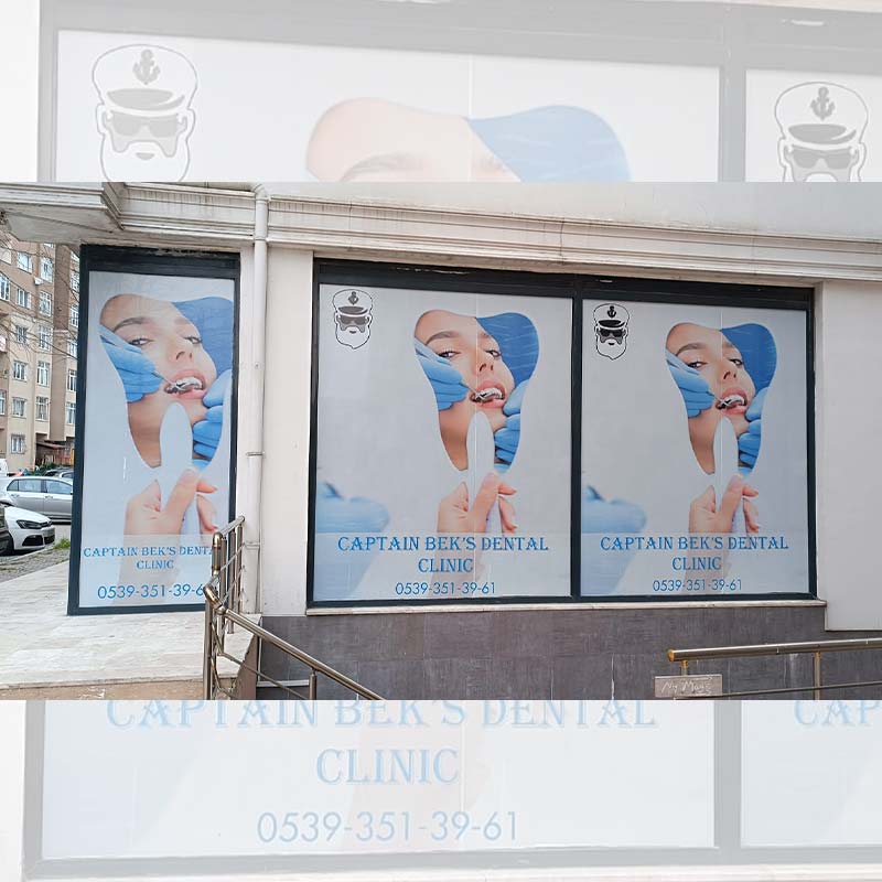 Captain Bek’s Dental Renkli Cam Giydirme | Antik Reklam - ANTİK REKLAM